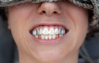 A színezett fogaknál őrültebb trendről nem hallottunk idén