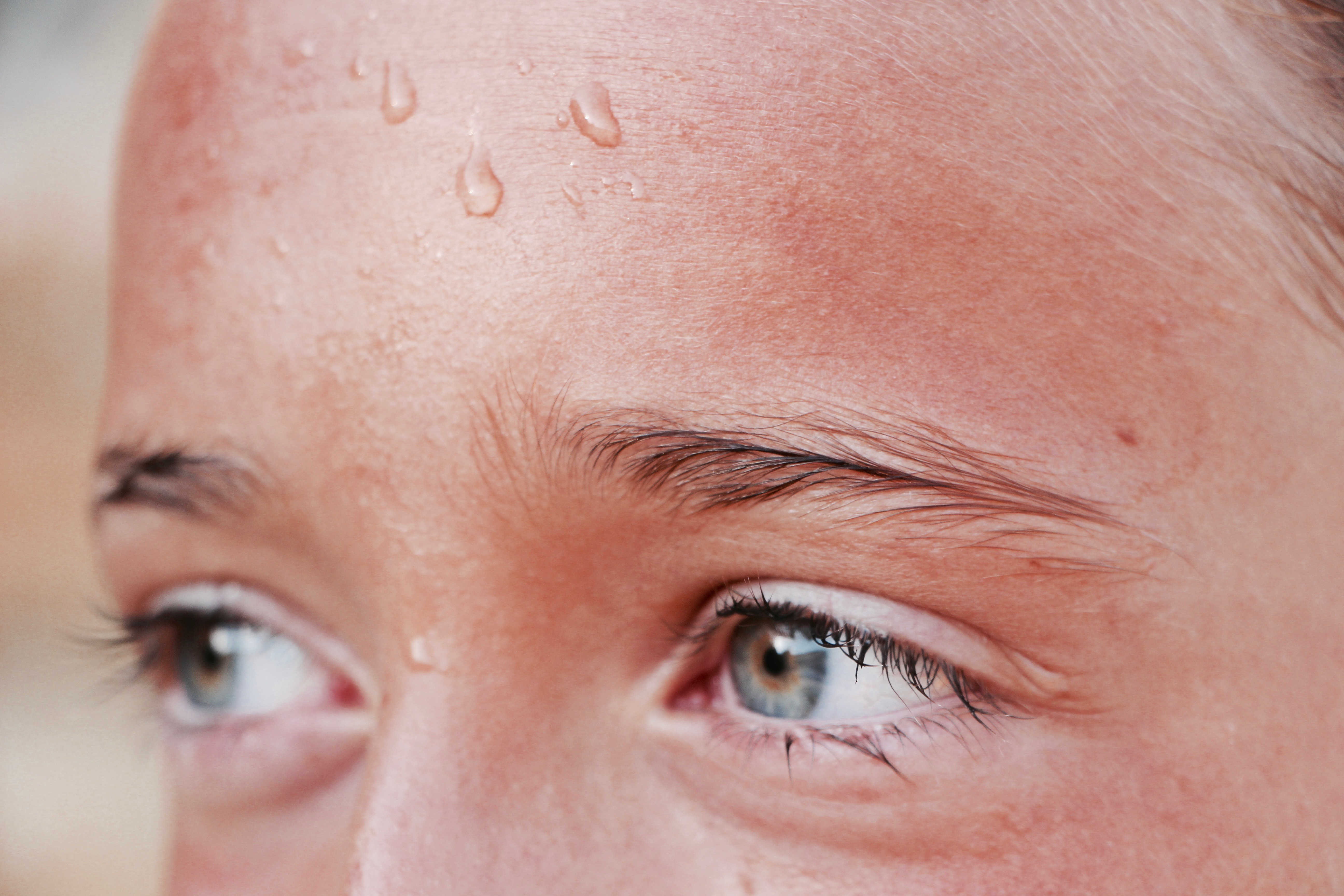 10+1 nyári bőrprobléma, amelyek megelőzhetőek