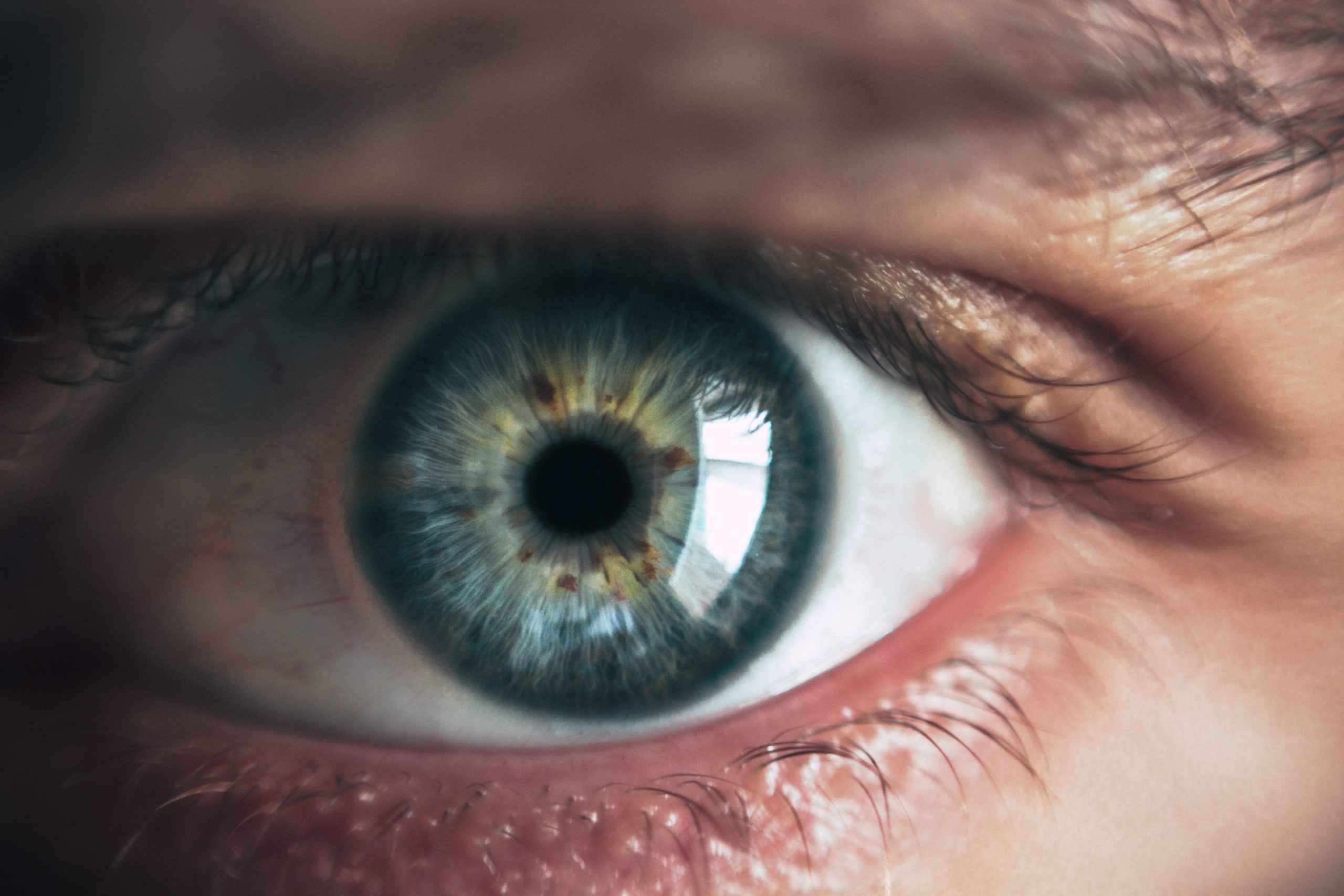 szem-retina-alzheimer-parkinson