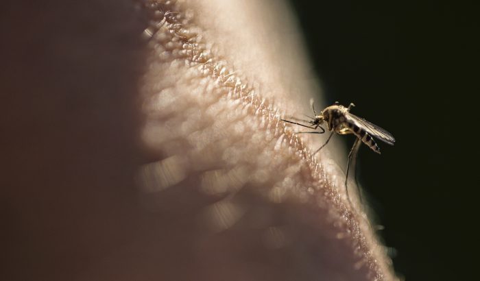 Allergiás vagy a szúnyogcsípésre? Lehet, hogy Skeeter-szindrómád van!