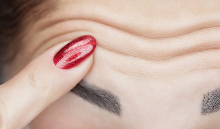 5 módszer a homlokráncok megelőzésére és elűzésére – botox nélkül