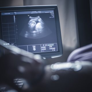 Abortusztörvény: a szívdobbanás, amit soha nem akartál hallani