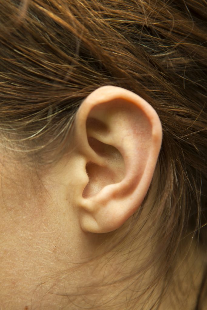 A fülcimpán 45 fokos szögben megjelenő hosszanti barázda szívbetegségre utal