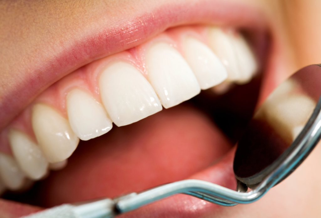 A száj és fogíny betegségei is okozhatják a nyál megváltozását