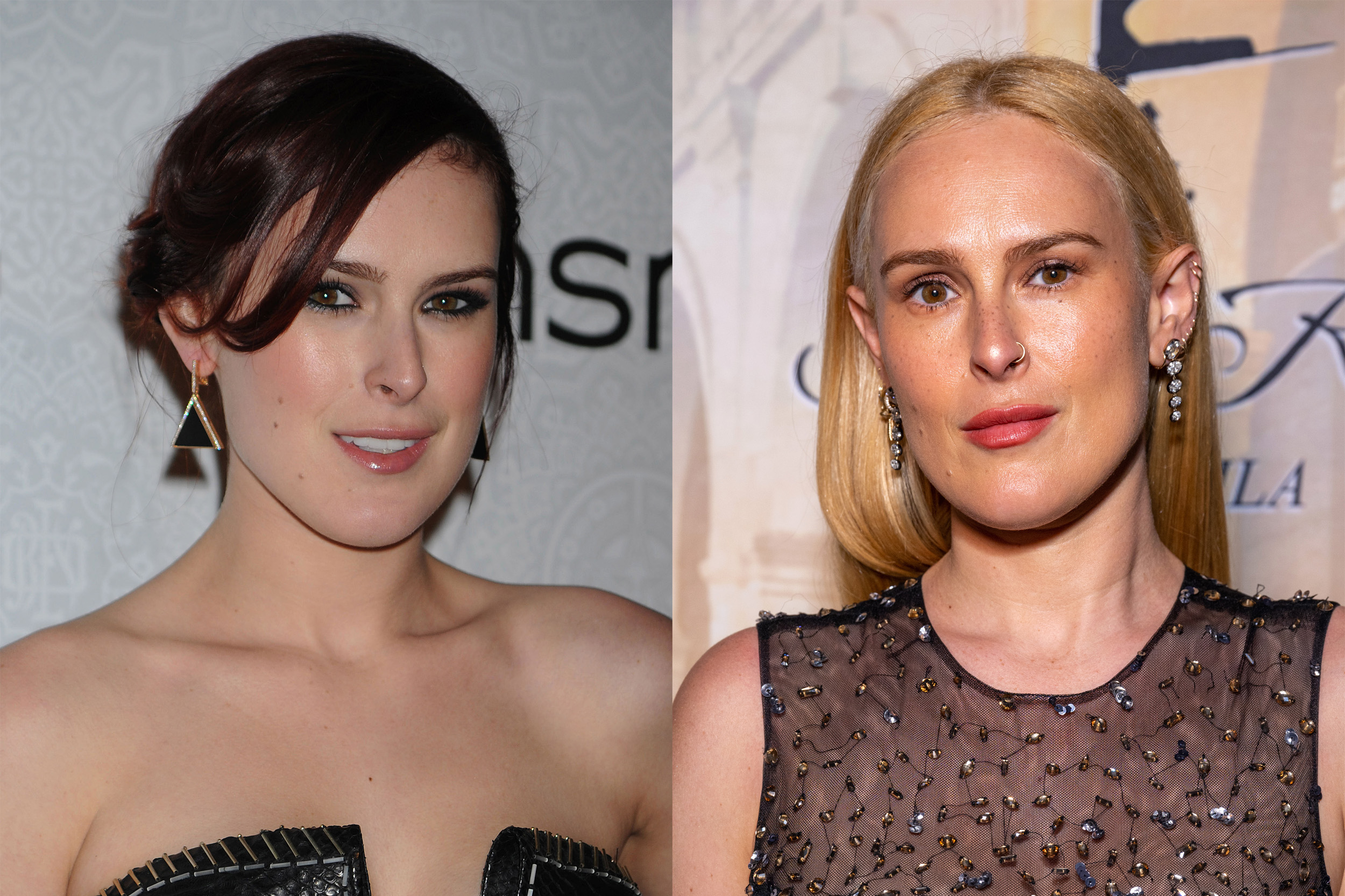 Rumer Willis ajakfeltöltés előtt és után