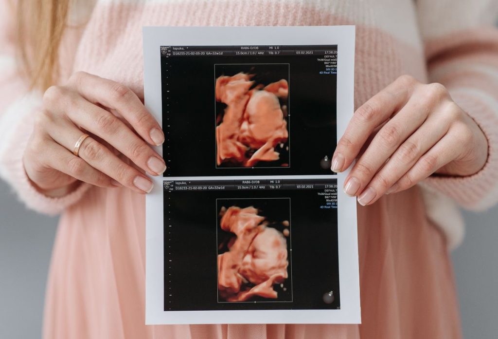 Már a magzati korban elkezdődnek azok a genetikai folyamatok, melyek hozzájárulhatnak az autoimmun betegségk kialakulásához