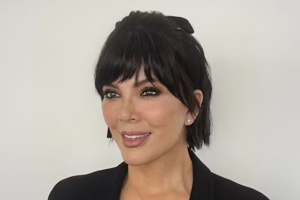 kris-jenner-arcplasztika
