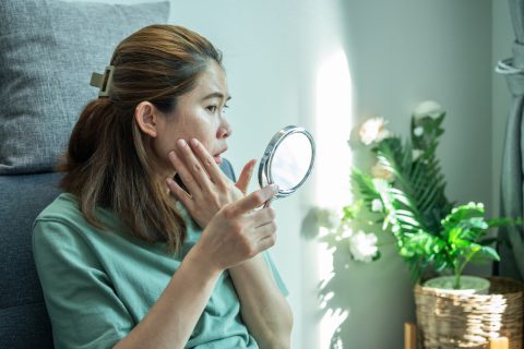 Az otthonod tesz pattanásossá