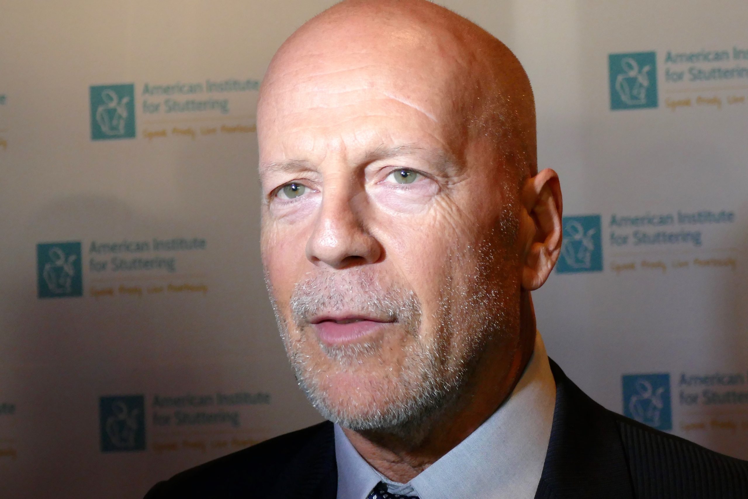 Bruce Willis betegsége