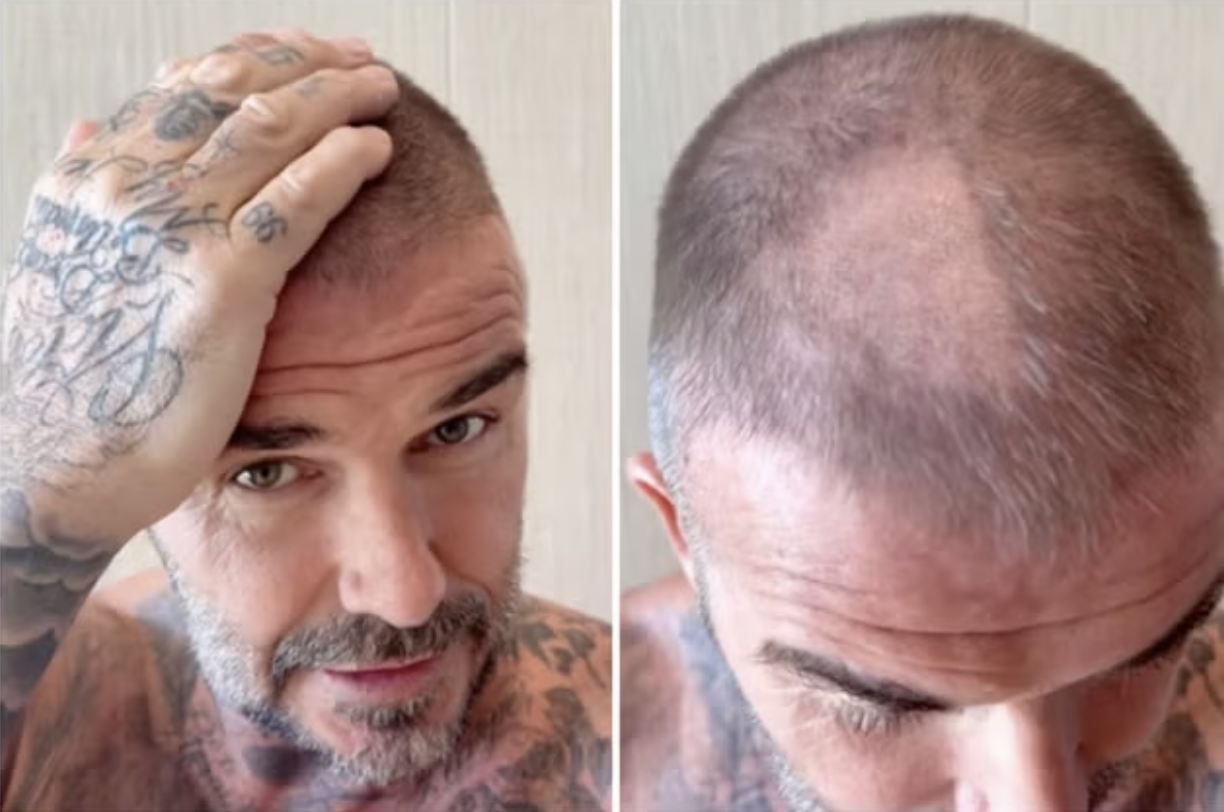 David Beckham megmutatja hogyan rontotta el a hajat