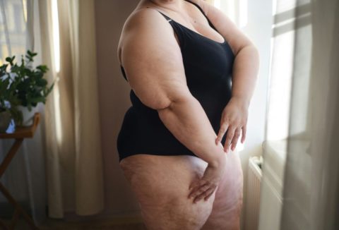 Elhízott nő fekete egyberészes fürdőruhában áll az ablak előtt