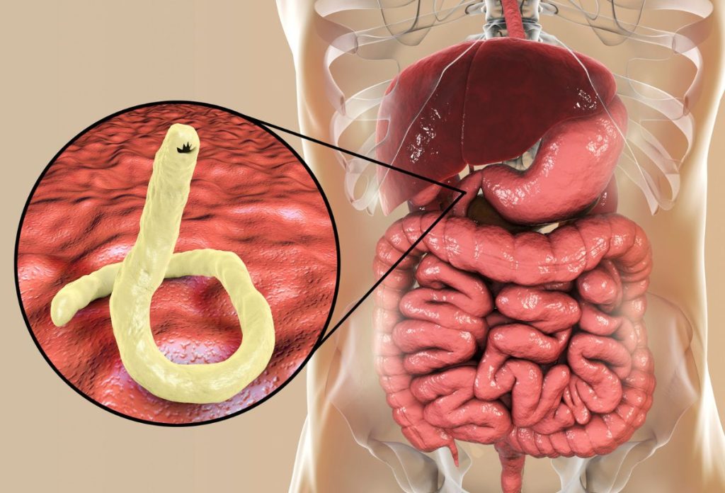 Horogféreg számítógépes rajza, mellette az emberi emésztőrendszer