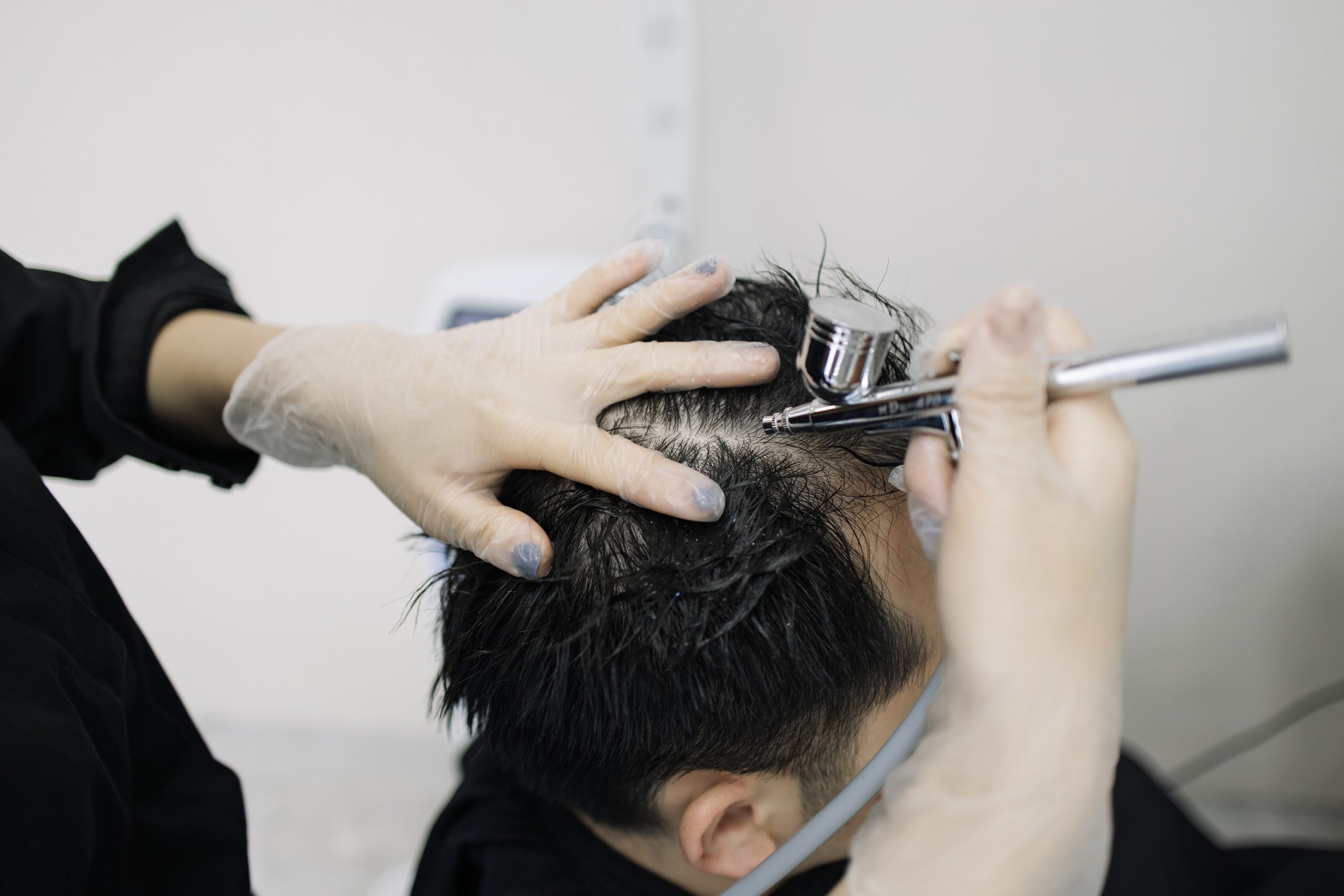 Férfi fejbőrét oxigénnel kezelik