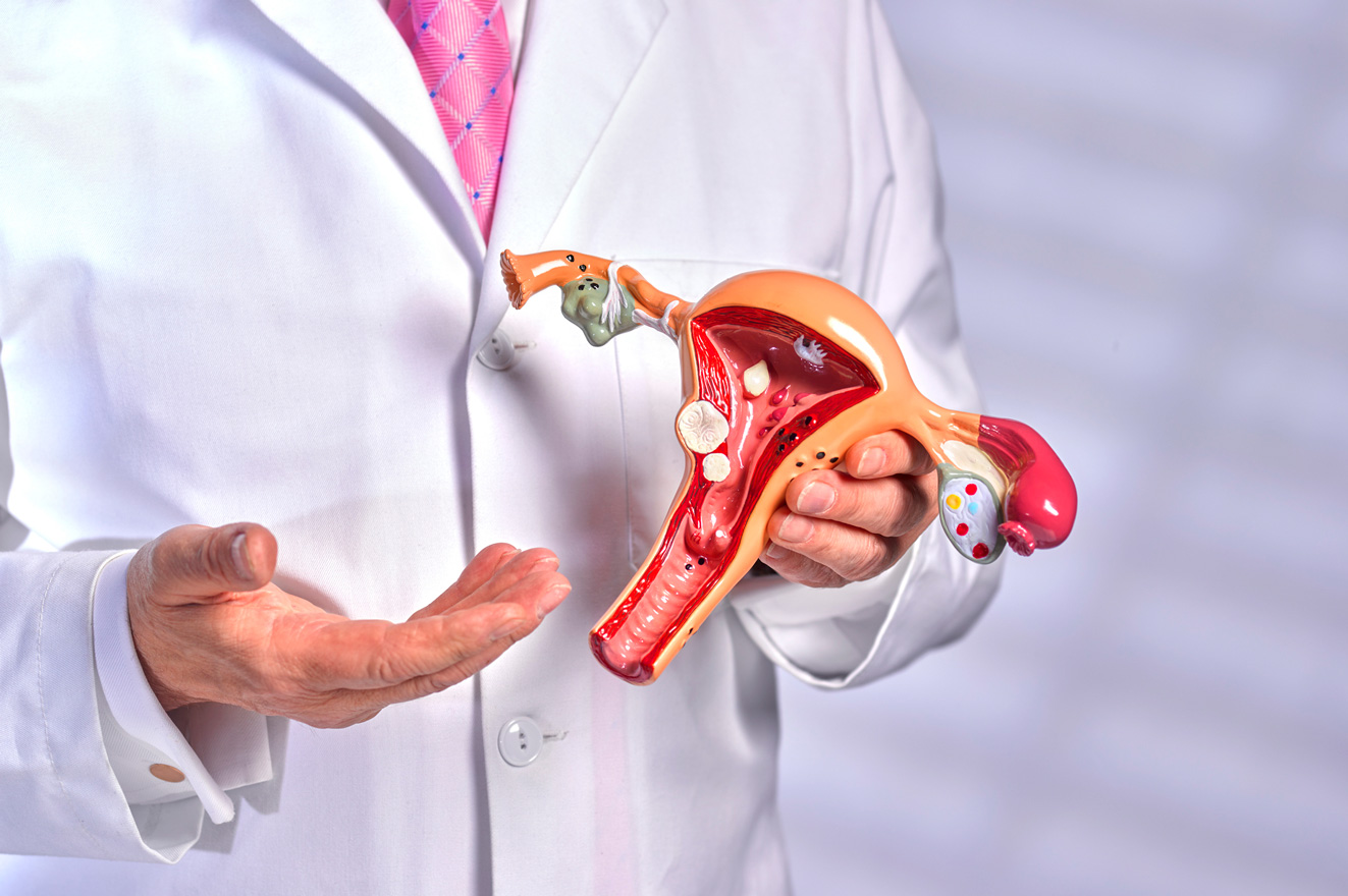 Szülész-nőgyógyász, a női méh és petefészek oktatási modelljét tartja a kezében