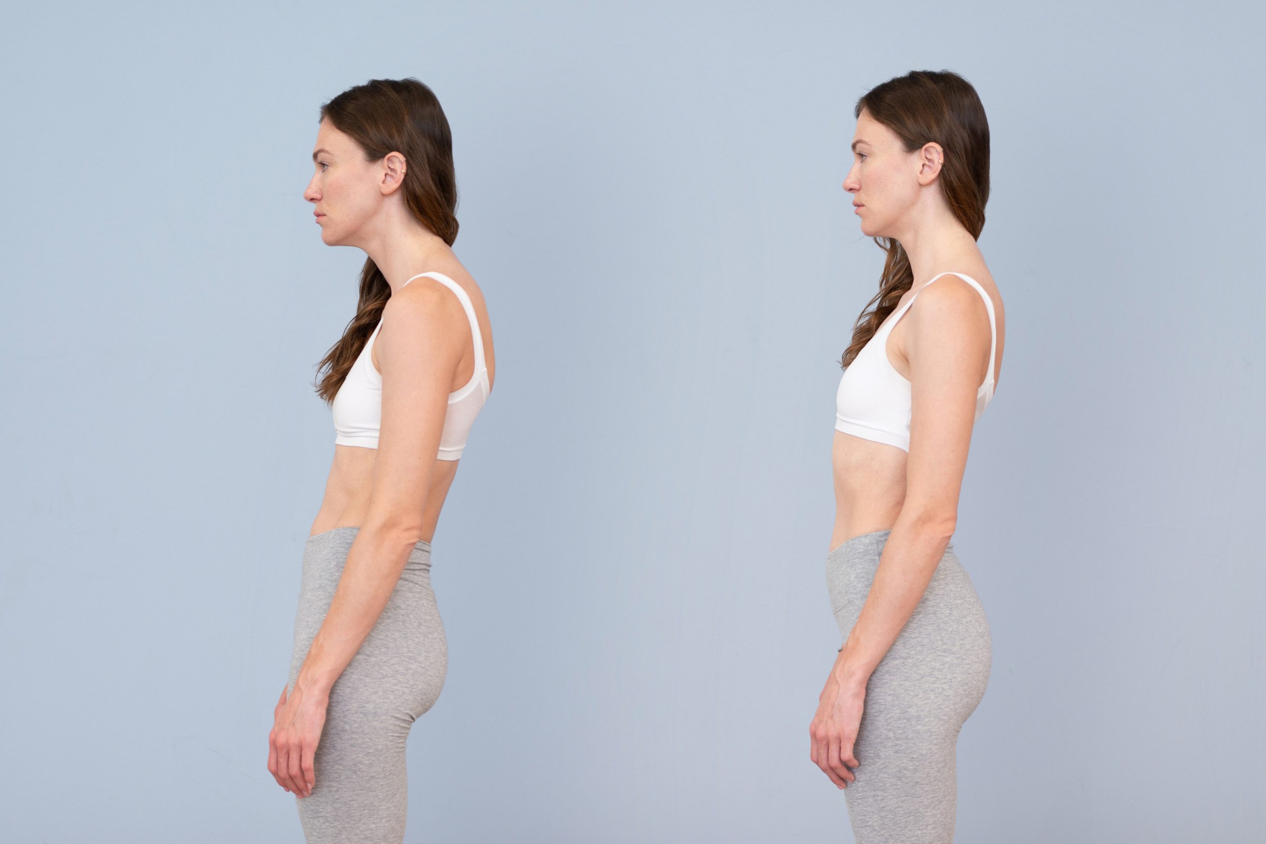 Két nő áll egymás mellett, az egyik rossz tartással, a másik helyes tartással