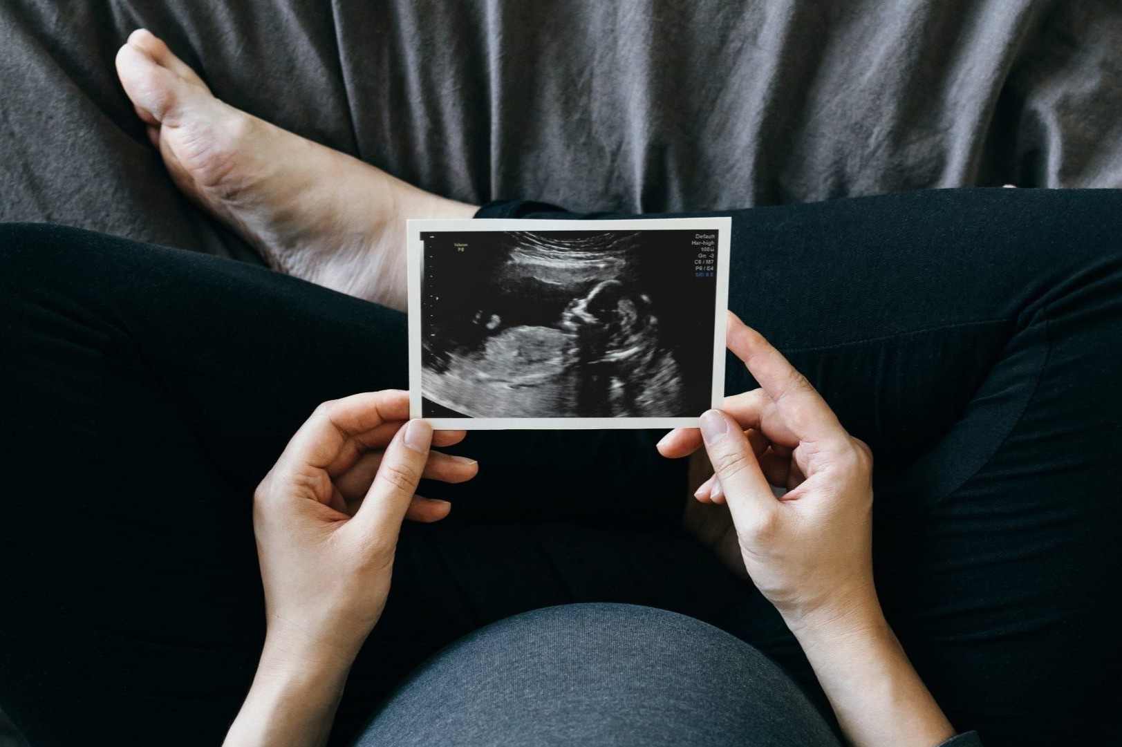 Terhes nő kezében tart egy ultrahang képet