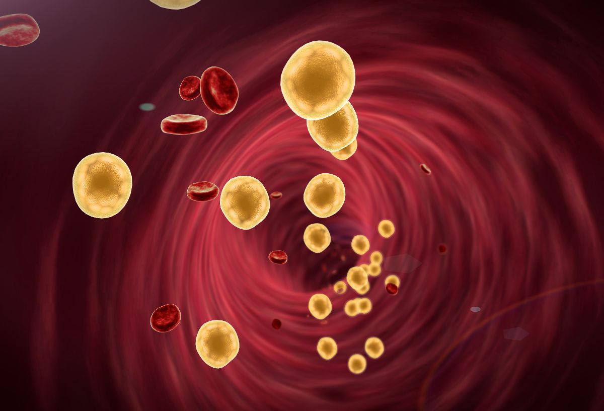 Számítógépes grafika egy érről, amiben vörösvérsejtek és sárgával koleszterinmolekulák haladnak