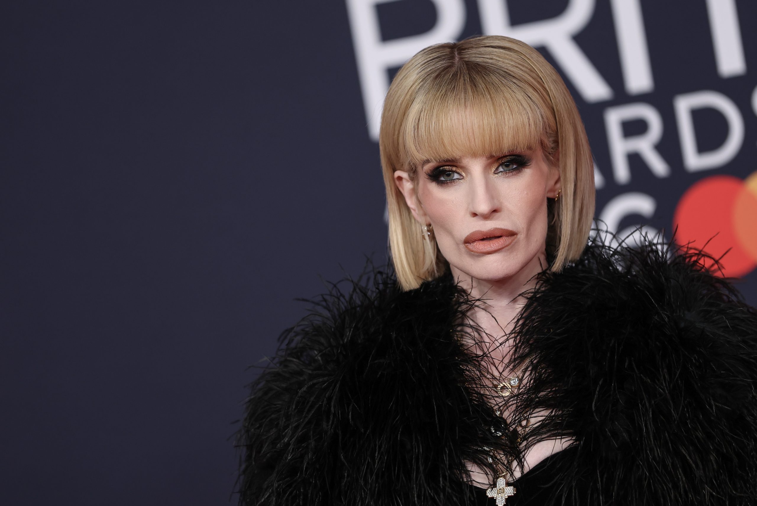 Kelly Osbourne drasztikus fogyása