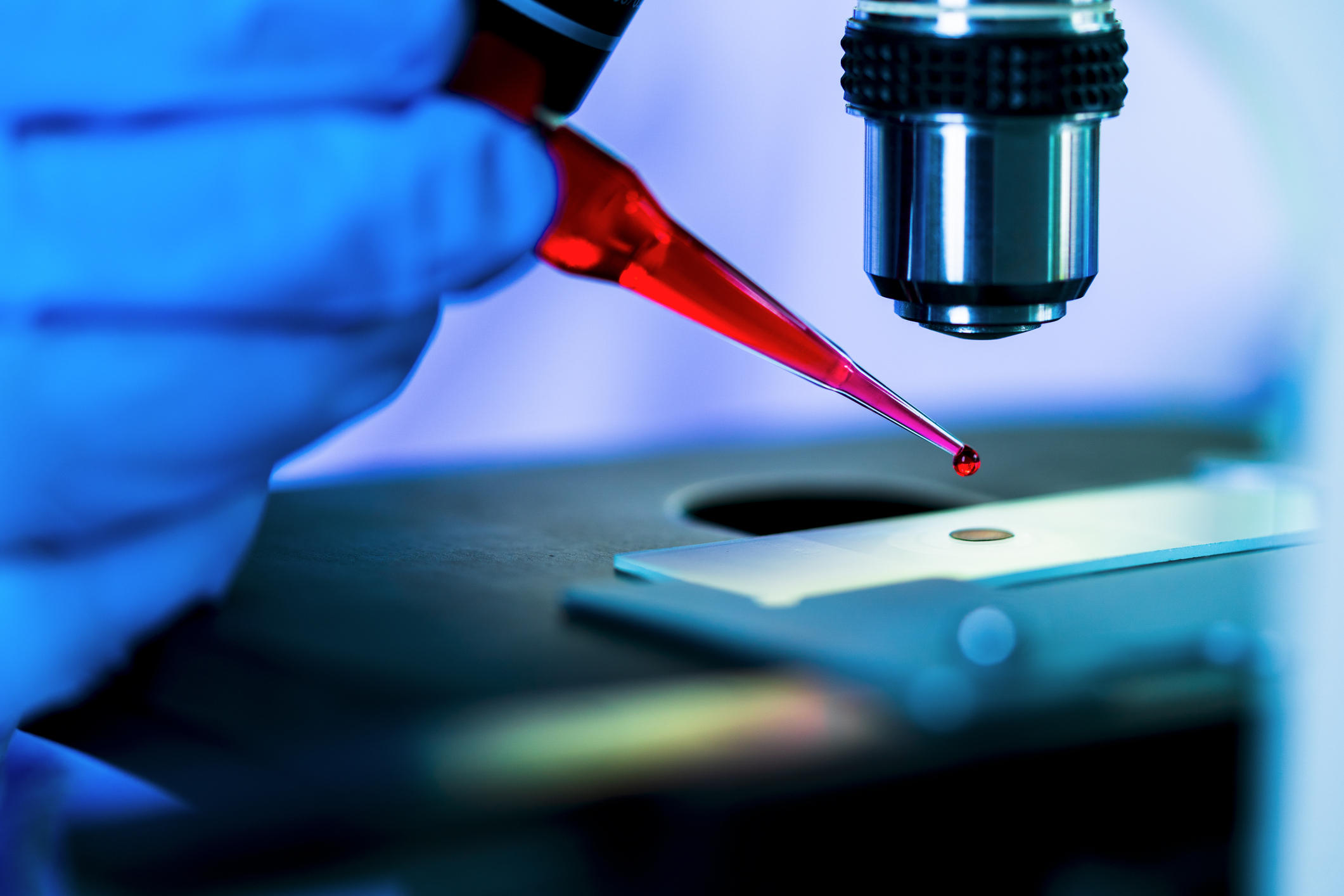 Orvosi vizsgálat vérből műszer segítségével