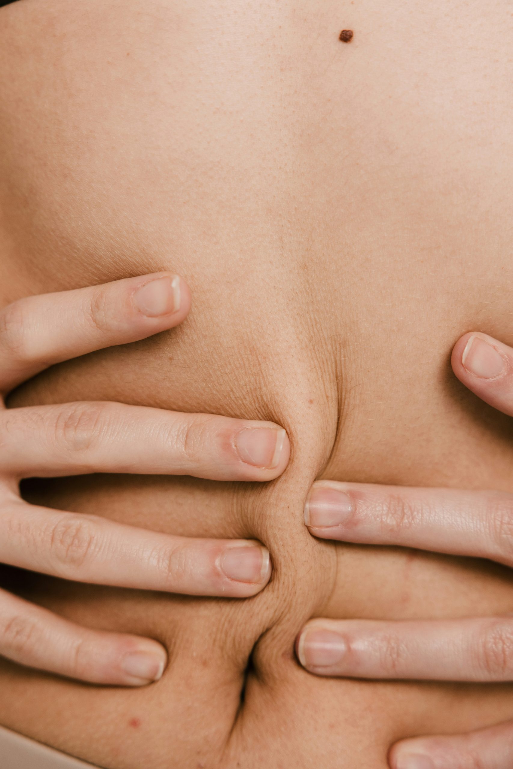 Közeli felvételen két kéz a has bőrét nyomja össze