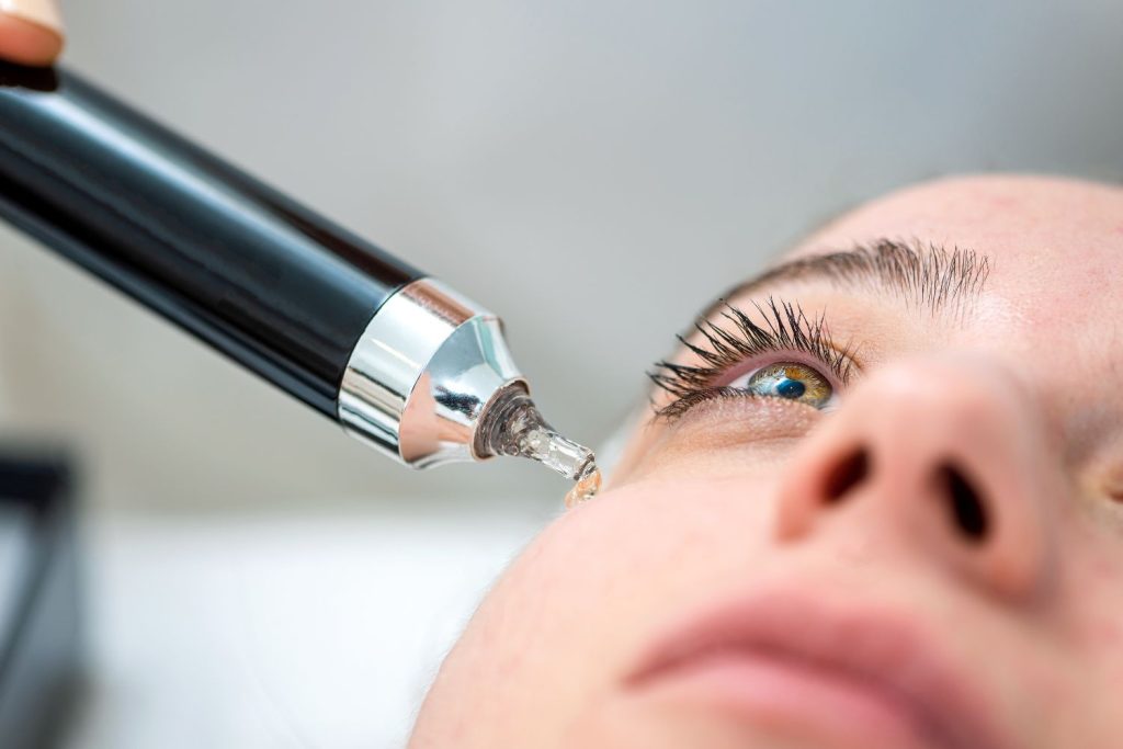 Kozmetikus glikolsavas kezelést végez nő arcán közeli képen