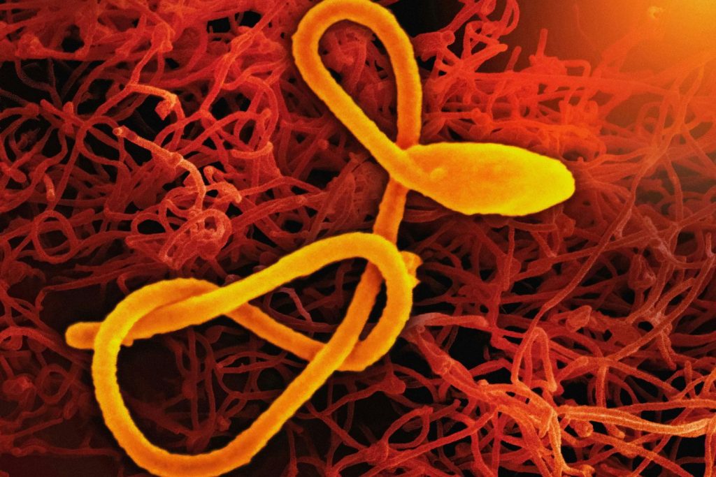 ebola-virus | Marie Claire Ebola vírus elektronmikroszkópos képe