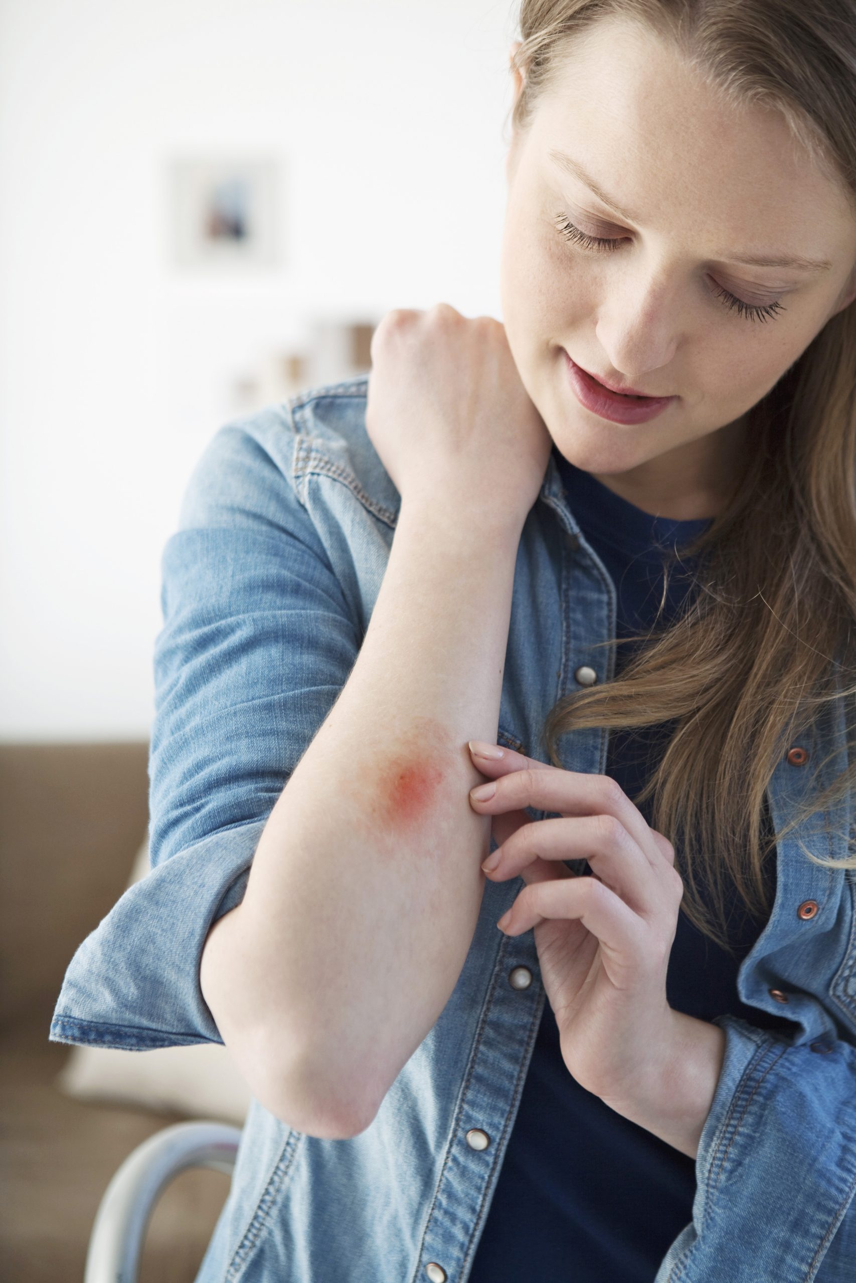 tunetek-mentot-hivni | Marie Claire 4. Égési sérülések: A kisebb elsőfokú égési sérüléseket - a bőr felső rétegének bőrpírját, duzzanatát és fájdalmát - általában otthon is el lehet kezelni. De ha az égés a kezek nagy részén, a lábakon, az arcon, a fenéken, az ágyékon vagy az egyik nagy ízületen, például a térden vagy a könyökön jelentkezik, akkor azonnal fordulj orvoshoz. Akkor is kérj sürgősségi orvosi segítséget, ha hólyagok, foltos bőr (másodfokú égés) jelentkezik, vagy ha az égési sérülés nagyobb, mint 7,5 cm, elszenesedett vagy fehér (harmadfokú égés).