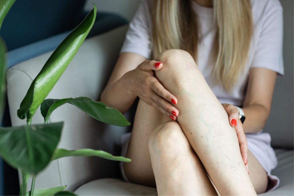 visszerbetegseg-kialakulasa | Marie Claire Nő keresztbetett lábbal ül fotelben, körülötte szobanövények, pirosra lakkozott körmökkel mutatja visszereit