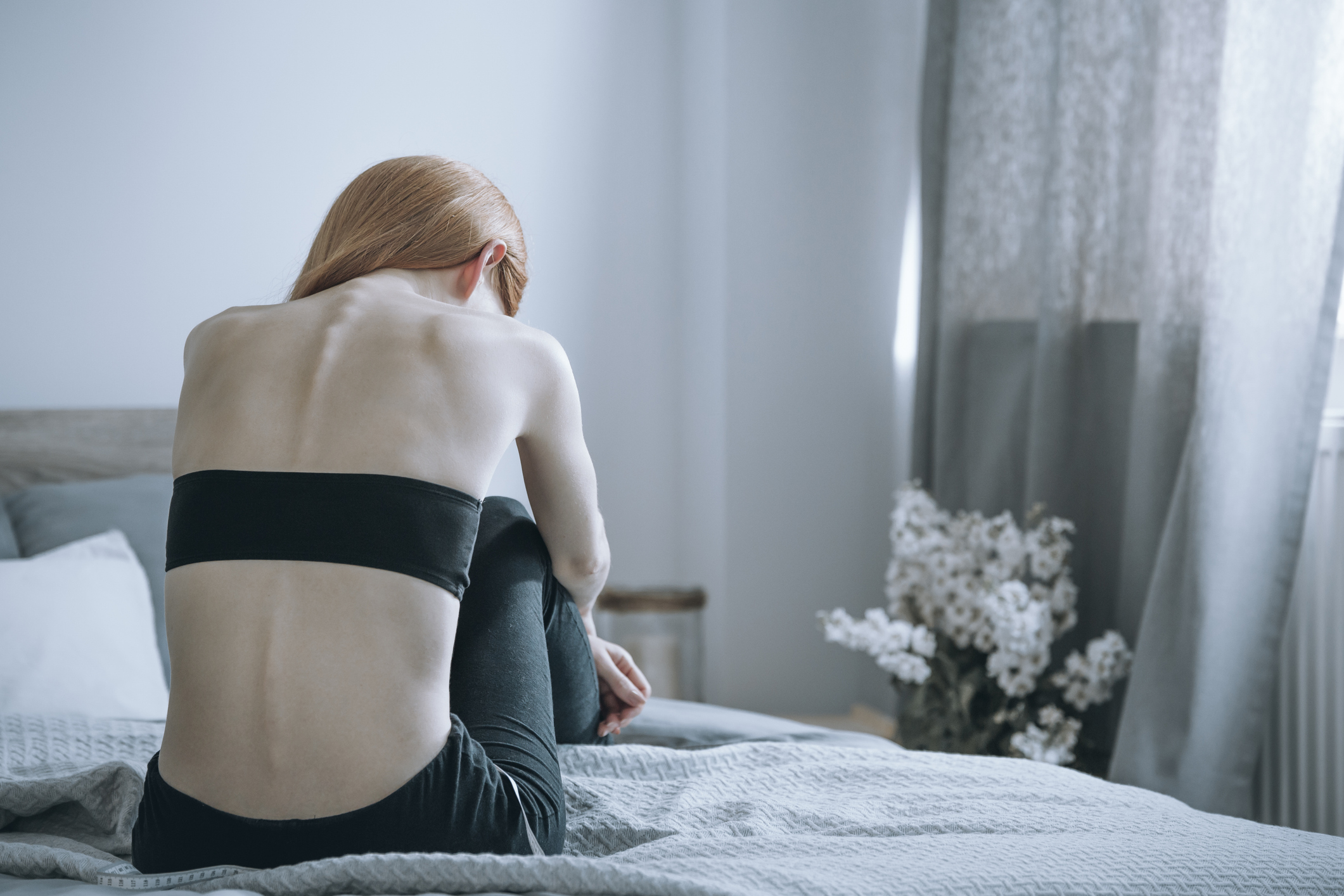 anorexiás nő